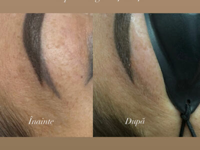 {"ARInfo":{"IsUseAR":false},"Version":"1.0.0","MakeupInfo":{"IsUseMakeup":false},"FaceliftInfo":{"IsChangeEyeLift":false,"IsChangeFacelift":false,"IsChangePostureLift":false,"IsChangeNose":false,"IsChangeFaceChin":false,"IsChangeMouth":false,"IsChangeThinFace":false},"BeautyInfo":{"SwitchMedicatedAcne":false,"IsAIBeauty":false,"IsBrightEyes":false,"IsSharpen":false,"IsOldBeauty":false,"IsReduceBlackEyes":false},"HandlerInfo":{"AppName":2},"FilterInfo":{"IsUseFilter":false}}