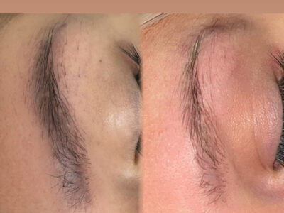 {"ARInfo":{"IsUseAR":false},"Version":"1.0.0","MakeupInfo":{"IsUseMakeup":false},"FaceliftInfo":{"IsChangeEyeLift":false,"IsChangeFacelift":false,"IsChangePostureLift":false,"IsChangeNose":false,"IsChangeFaceChin":false,"IsChangeMouth":false,"IsChangeThinFace":false},"BeautyInfo":{"SwitchMedicatedAcne":false,"IsAIBeauty":false,"IsBrightEyes":false,"IsSharpen":false,"IsOldBeauty":false,"IsReduceBlackEyes":false},"HandlerInfo":{"AppName":2},"FilterInfo":{"IsUseFilter":false}}